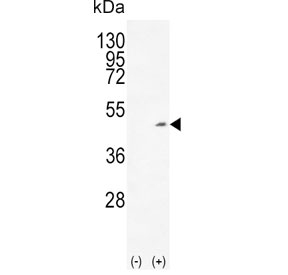 Western blot testing of 1) non-transfected and 2) transfected 293 cell lysate with ADH1C antibody.