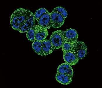 Immunofluorescent staining of human T-47D cells with ADH1C antibody (green) and DAPI nuclear stain (blue).