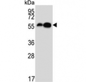 Western blot testing of mouse 1) liver and 2) kidney lysate with AADC antibody. Predicted molecular weight ~54 kDa.