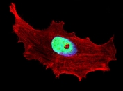 Immunofluorescent staining of fixed and permeabilized human MCF7 cells with BHLHE41 antibody (green), DAPI nuclear stain (blue) and anti-Actin (red).