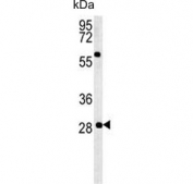 Western blot testing of mouse testis lysate with GSTO2 antibody. Predicted molecular weight ~28 kDa.