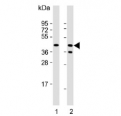 Western blot testing of human 1) Jurkat and 2) Raji cell lysate with CD82 antibody. Expected molecular weight: 30-60 kDa depending on glycosylation level.