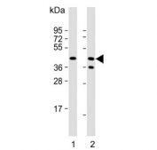 Western blot testing of human 1) Jurkat and 2) Raji cell lysate with CD82 antibody. Expected molecular weight: 30-60 kDa depending on glycosylation level.