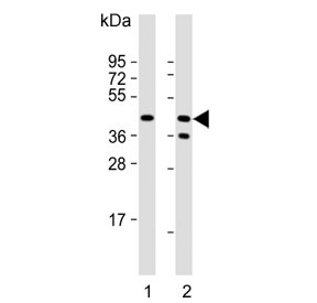 Western blot testing of human 1) Jurkat and 2) Raji cell lysate with CD82 antibody. Expected molecular weight: 30-60 kDa depending on glycosylation level.