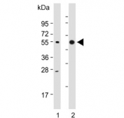 Western blot testing of human 1) MGC803 and 2) MKN45 lysate with CTSE antibody. Predicted molecular weight ~43 kDa.