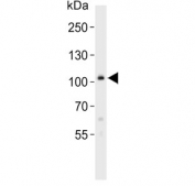 Western blot testing of human A431 cell lysate with COL6A1 antibody. Predicted molecular weight ~109 kDa, routinely observed at 140-150 kDa.