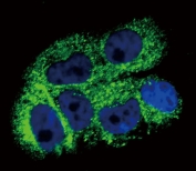 Immunofluorescent staining of human A2058 cells with COL6A1 antibody (green) and DAPI nuclear stain (blue).