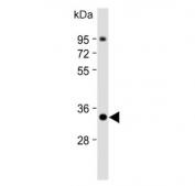 Western blot testing of human MOLT4 lysate with ZWINT antibody. Predicted molecular weight ~31 kDa.