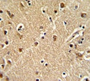 IHC testing of FFPE human brain tissue with ZWINT antibody. HIER: steam section in pH6 citrate buffer for 20 min and allow to cool prior to staining.