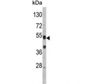 Western blot testing of mouse liver lysate with Serpin C1 antibody. Predicted molecular weight ~52 kDa.