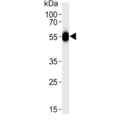 Western blot testing of human blood plasma lysate with Serpin C1 antibody. Predicted molecular weight ~52 kDa.