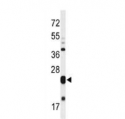 Western blot testing of mouse heart lysate with MLF1 antibody. Predicted molecular weight ~31 kDa.