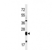 Western blot testing of mouse heart lysate with MLF1 antibody. Predicted molecular weight ~31 kDa.