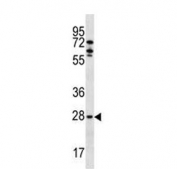 Western blot testing of human MCF7 lysate with MLF1 antibody. Predicted molecular weight ~31 kDa.