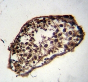 IHC testing of FFPE human testis tissue with MLF1 antibody. HIER: steam section in pH6 citrate buffer for 20 min and allow to cool prior to staining.