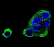 Immunofluorescent staining of human HepG2 cells with ADH1B antibody (green) and DAPI nuclear stain (blue).