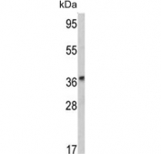 Western blot testing of human HepG2 cell lysate with ADH1B antibody. Predicted molecular weight ~40 kDa.