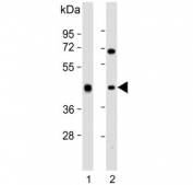 Western blot testing of human 1) liver and 2) Jurkat cell lysate with ADH1B antibody. Predicted molecular weight ~40 kDa.