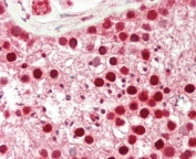 IHC testing of FFPE human testis tissue with CDK14 antibody. HIER: steam section in pH6 citrate buffer for 20 min and allow to cool prior to staining.