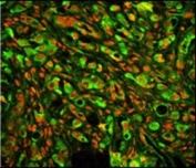 Immunofluorescent staining of human prostate carcinoma cells with PTP4A2 antibody (green) PI (red).