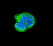 Immunofluorescent staining of fixed and permeabilized human MCF7 cells with Aspartoacylase antibody (green) and DAPI nuclear stain (blue).