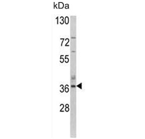 Western blot testing of human MCF7 cell lysate with Aspartoacylase antibody. Predicted molecular weight ~36 kDa.