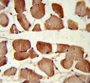 IHC testing of FFPE human skeletal muscle tissue with Aspartoacylase antibody. HIER: steam section in pH6 citrate buffer for 20 min and allow to cool prior to staining.