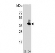 Western blot testing of 1) non-transfected and 2) transfected 293 cell lysate with Aspartoacylase antibody.
