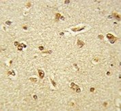 IHC testing of FFPE human brain tissue with GTF2I antibody. HIER: steam section in pH6 citrate buffer for 20 min and allow to cool prior to staining.