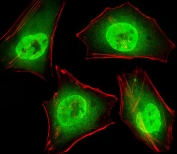 Immunofluorescent staining of human HeLa cells with GTF2I antibody (green) and anti-Actin (red).