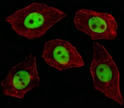 Immunofluorescent staining of fixed and permeabilized human A549 cells with GTF2I antibody (green) and anti-Actin (red).
