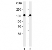 Western blot testing of human 1) A431 and 2) HeLa lysate with GTF2I antibody. Predicted molecular weight ~112 kDa but can be observed at up to ~135 kDa.
