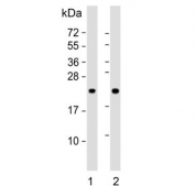Western blot testing of human 1) Jukat and 2) Raji cell lysate with CBFB antibody. Predicted molecular weight ~22 kDa.