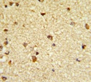 IHC testing of FFPE human brain tissue with CBFB antibody. HIER: steam section in pH6 citrate buffer for 20 min and allow to cool prior to staining.