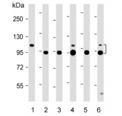 Western blot testing of 1) human skeletal muscle, 2) mouse ATDC5, 3) HUVEC, 4) human Jurkat, 5) human MG-63 and 6) human U-2 OS lysate with TSP5 antibody. Expected molecular weight: 83-100 kDa depending on glycosylation level.