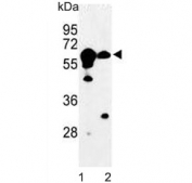 Western blot testing of 1) mouse kidney and 2) human Ramos lysate with Cystathionine Beta Synthase antibody. Predicted molecular weight ~61 kDa.