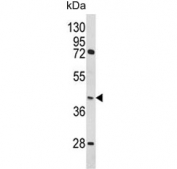 Western blot testing of human MDA-MB-231 cell lysate with HOMER3 antibody. Predicted molecular weight ~40 kDa, can be observed at 45-47 kDa.