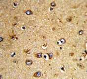 IHC testing of FFPE human brain tissue with HOMER3 antibody. HIER: steam section in pH6 citrate buffer for 20 min and allow to cool prior to staining.