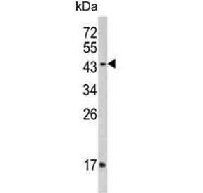 Western blot testing of human MDA-MB-453 lysate with IFNGR2 antibody. Expected molecular weight: 37-55 kDa.