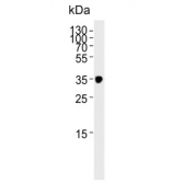 Western blot testing of human skeletal muscle lysate with IFNGR2 antibody. Expected molecular weight: 37-55 kDa.