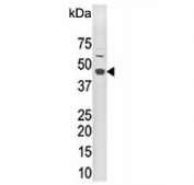 Western blot testing of mouse brain lysate with LYK5 antibody. Predicted molecular weight ~48 kDa.