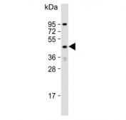 Western blot testing of human A549 cell lysate with LYK5 antibody. Predicted molecular weight ~48 kDa.