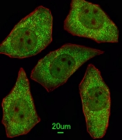 Immunofluorescent staining of human A549 cells with MSRA antibody (green) and anti-Actin (red).