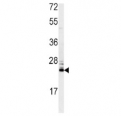 Western blot testing of mouse kidney lysate with MSRA antibody. Predicted molecular weight ~26 kDa.
