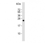 Western blot testing of human kidney lysate with MSRA antibody. Predicted molecular weight ~26 kDa.