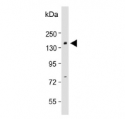 Western blot testing of mouse liver lysate with BCOR antibody. Predicted molecular weight ~192 kDa.