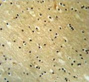 IHC testing of FFPE mouse brain tissue with BCOR antibody. HIER: steam section in pH6 citrate buffer for 20 min and allow to cool prior to staining.