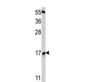Western blot testing of mouse NIH 3T3 cell lysate with RBM3 antibody. Predicted molecular weight ~17 kDa.