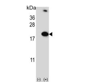 Western blot testing of 1) non-transfected and 2) transfected 293 cell lysate with RBM3 antibody.
