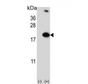 Western blot testing of 1) non-transfected and 2) transfected 293 cell lysate with RBM3 antibody.